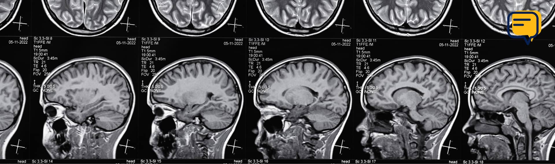 Behind the Images: A Look into Radiology with Dr. Eric Balle with radiology images